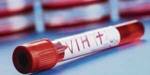 Nuevos avances hacia una vacuna eficaz frente al VIH gracias a una estrategia secuencial