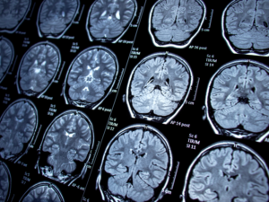 Descubren un nuevo circuito cerebral que detecta rápidamente las caras