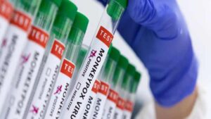 Pakistán registró su primer caso de mpox y dos sospechosos