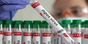 Autoridades de Colombia activan operativo para detectar casos de mpox en la frontera con Venezuela 