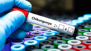 EE.UU. suspende licencia de venta de vacuna contra chikungunya por efectos secundarios